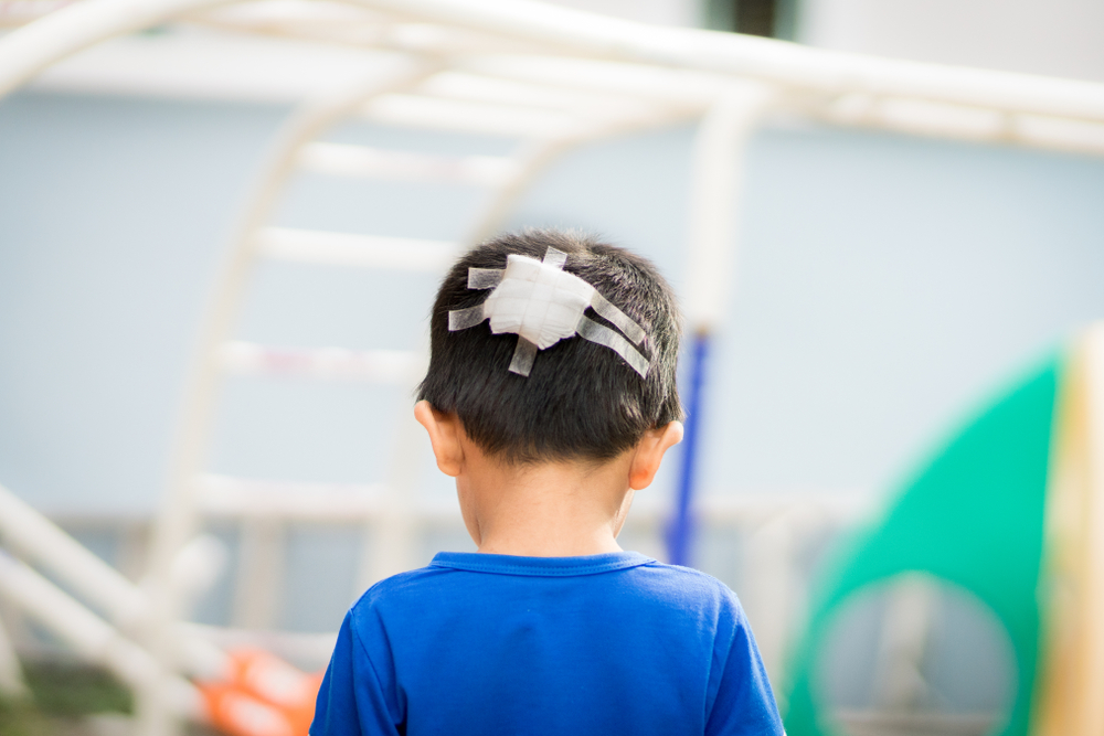 personal injury lawsuit for your child in Florida