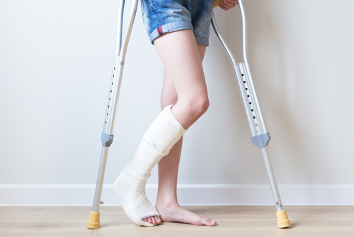 How Much Is My Broken Leg Worth in a Personal Injury Lawsuit?